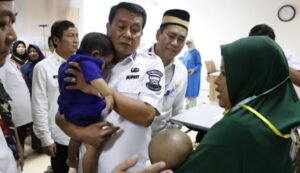 Bupati Tangerang Tinjau Operasi Bibir Sumbing Gratis di RSUD Balaraja”